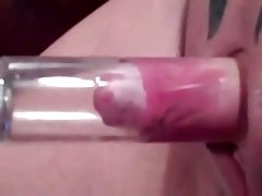 Clitoris grande, Clitoris, Enorme