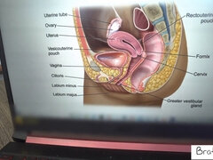 Stepmom teaches stepson how to make a girl cum in this hot POV video