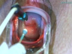 素人, お尻, ブロンド, 気狂い, 医者, フェティッシュ, 挿入, ガリガリ