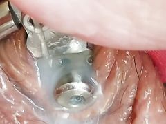 First time cumming in my inverted chastity device 5 inch urethral catheter tube