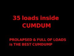 35 sperm loads inside CumDump. Prolapsed bottom is the best