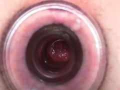 Glance inwards my butthole - Gape Fart ASMR