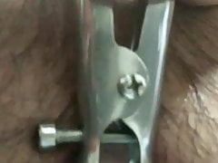 First use of speculum