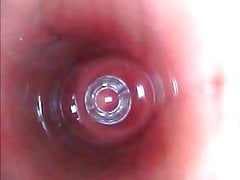 Endoscope Photo Galery - Male Rectal Insertion