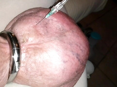 Filling up with glucose 1liter