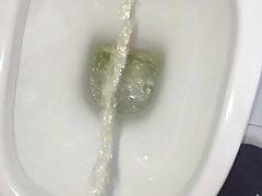 Urina con scappellata