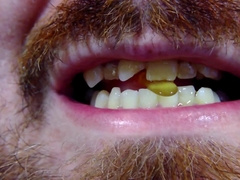 Taking some cough spurts for a aching jaws