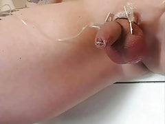 2l glucose infusion timelapse in scrotum