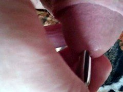 Schmuck Dilator fuer den Prinzen