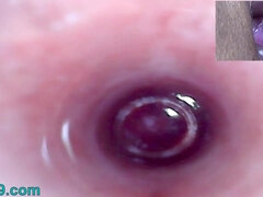 Sperma, Extreem, Vuisten, Gynaecoloog, Hardcore, Koreaans, Rijpe lesbienne, Spuiten