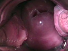 Checa, Ginecologo, Indio, Inserción, Masturbación, Orgasmo, Esposa