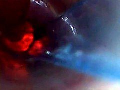 Insertion, Pov, Voyeur