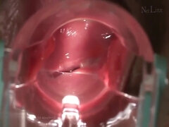 Creampie Speculum Compilation - Cervix covered in Cum