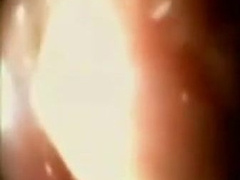 This is what happens inside your ass - delightful? 8