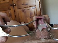 Stretched foreskin plus cumshots