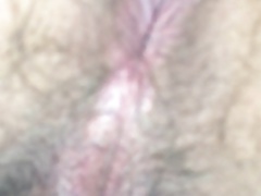 asshole