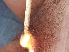 Burning Pubic Hair