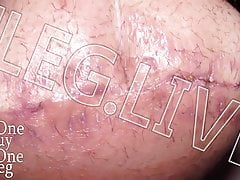 1leg.live 28 days post op,full 4K video available to my fans