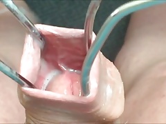 Foreskin with three cumshots !