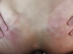 Buco allargato