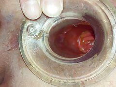 Tunnel plug