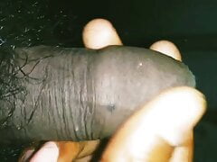 Indian boy showing cream under forskin