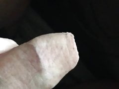 Foreskin show off