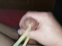 catheter cum wiht ch 14