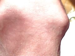 Foreskin in sunlight - 5 minute video