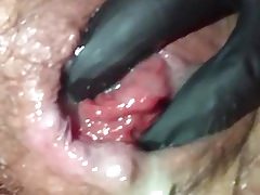 Gape