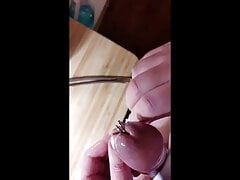 Hot wax stretched urethra