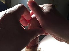 Sunshine foreskin - 5 of 8