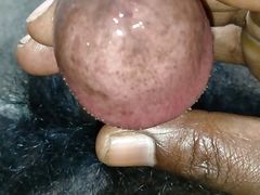 my sensitive penis