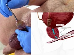 Peehole play, doctor, peehole insertion