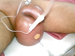 My friend doing saline infusion in my balls first time