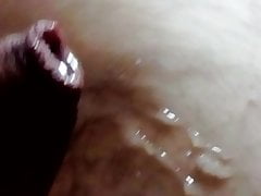 Foreskin shoot