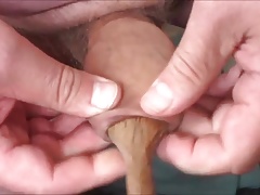 Saturday foreskin - 8 videos