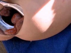 Mancunt extreme - my loose gaping sloppy asshole 6