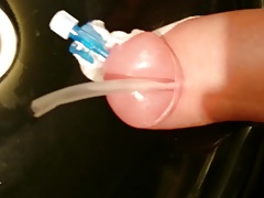 FORESKIN MASSIVE