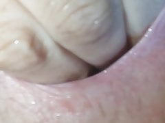my asshole