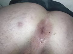 Anal gaping