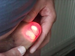 More crazy foreskin torch videos