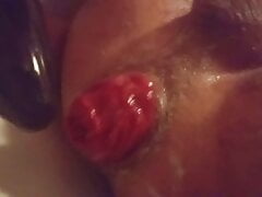 Destroying anal prolapse series episode one